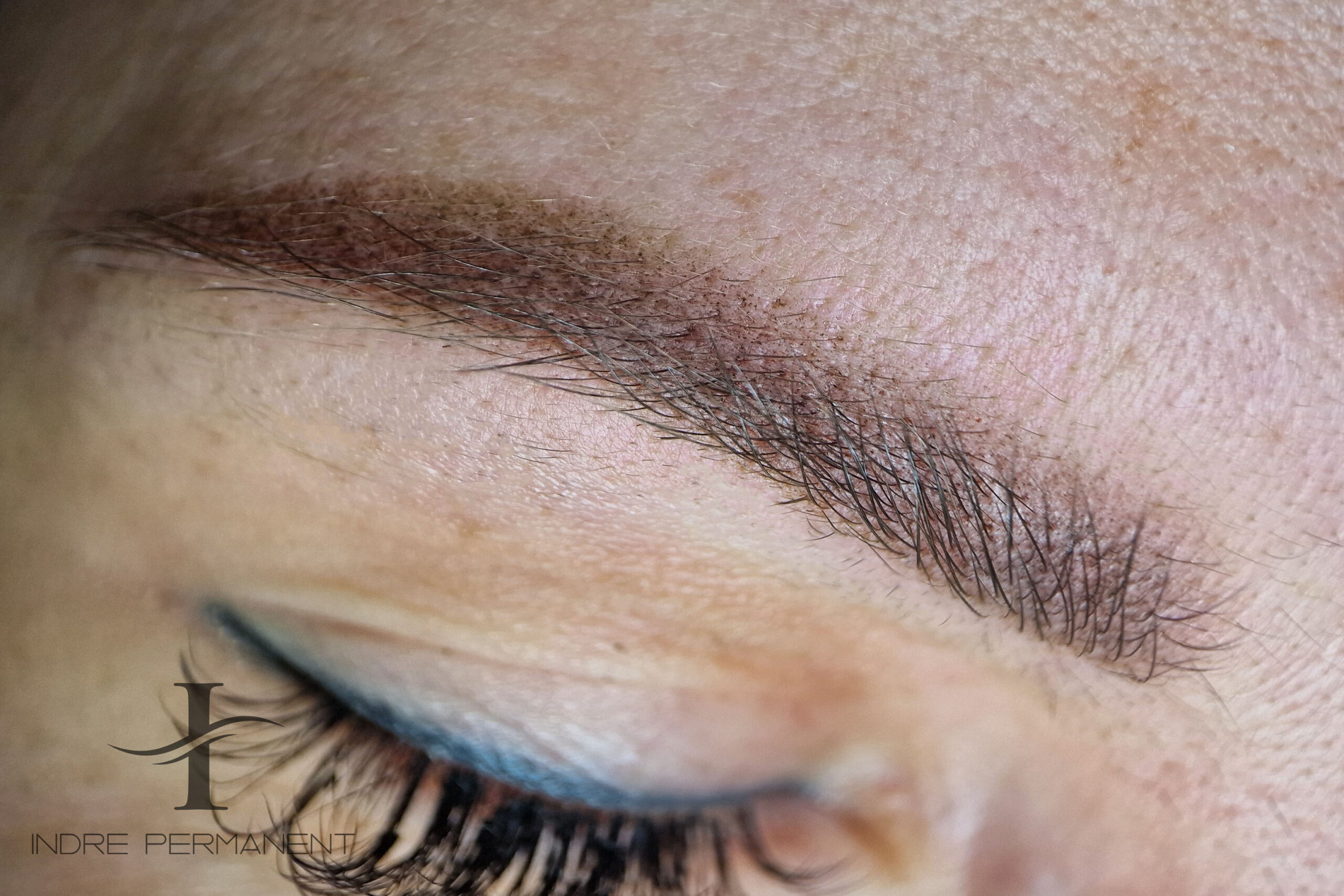 antakiu ilgalaikis makiazas