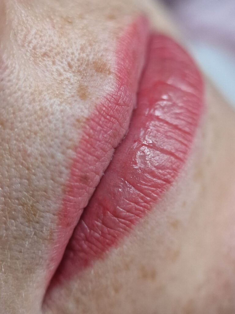 Sugijęs lūpų ilgalaikis makiažas praėjus metams po procedūros