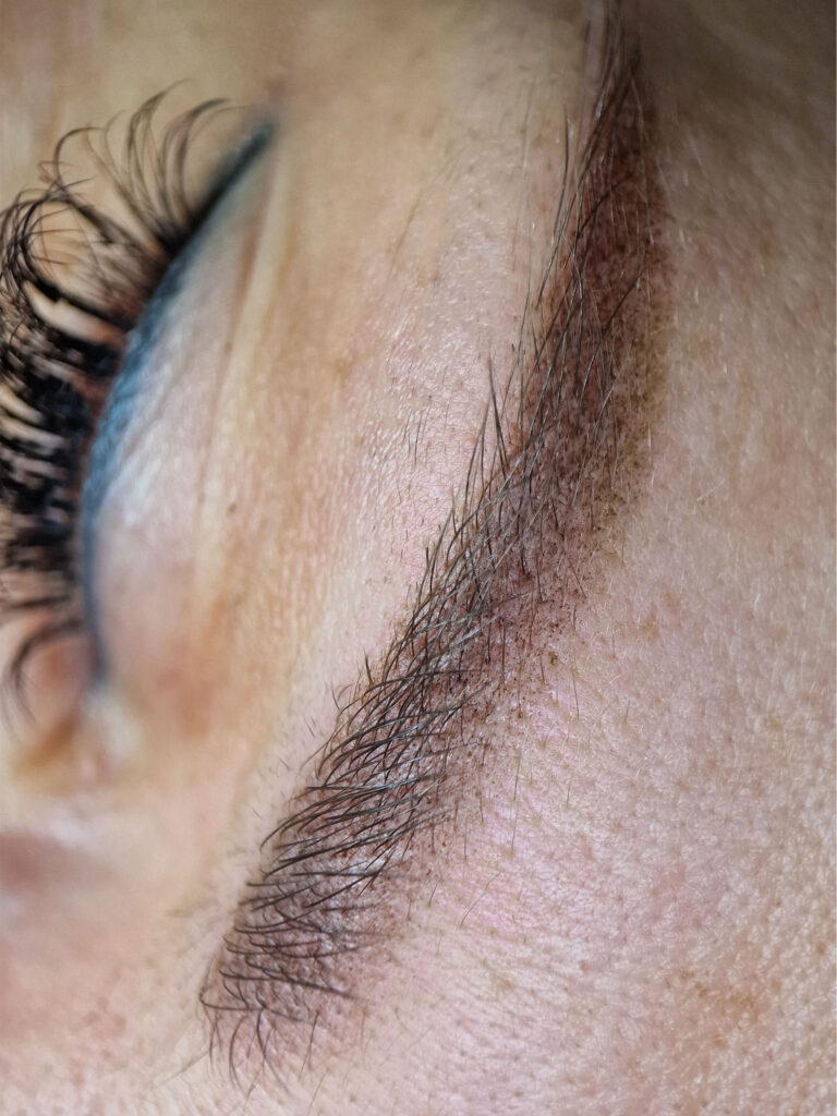 Antakių ilgalaikis makiažas ką tik po procedūros