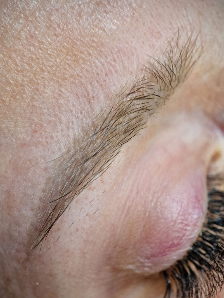 Antakių ilgalaikis makiažas praėjus 2 metams