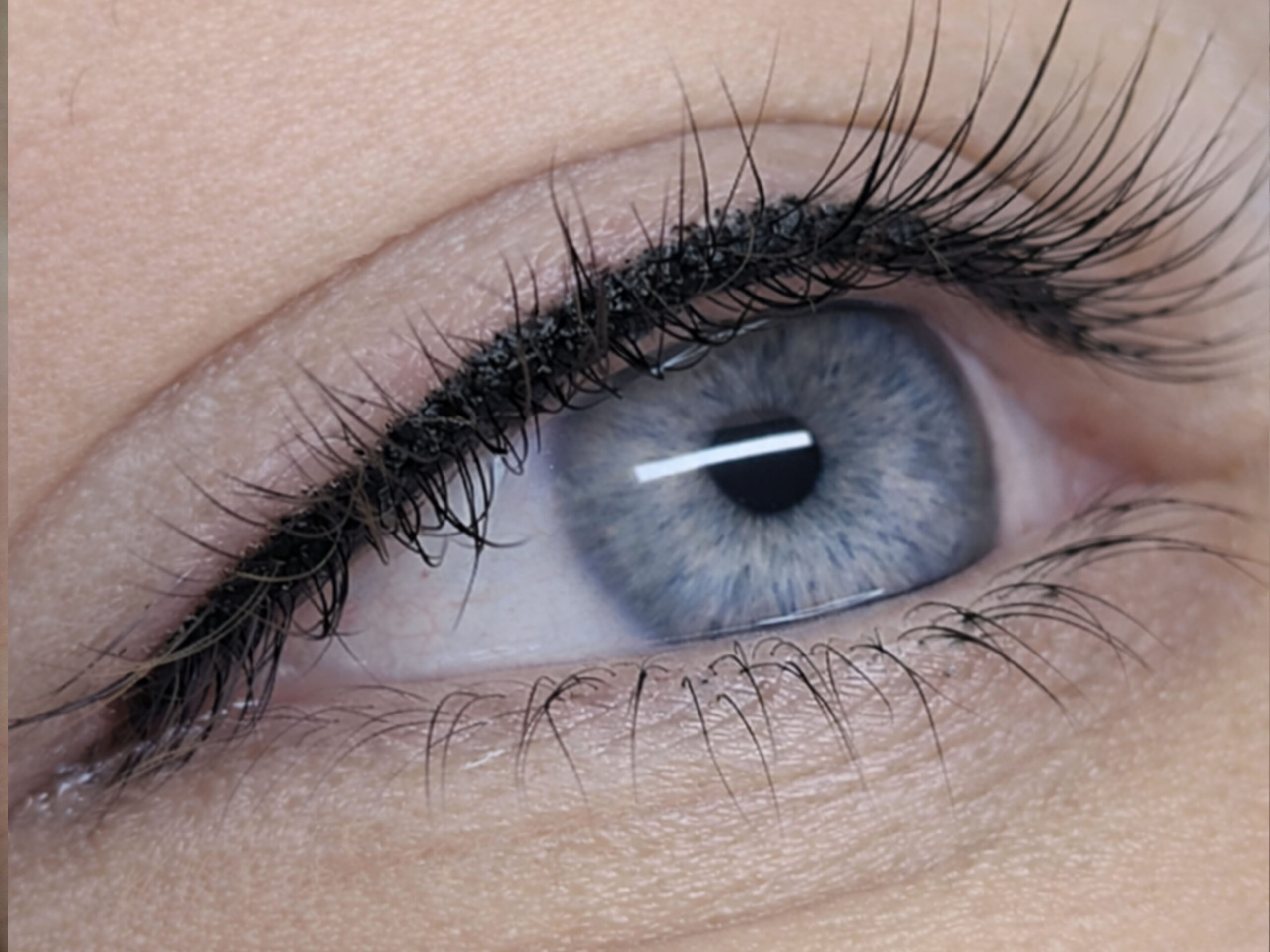 pravedimas tarp blakstienu