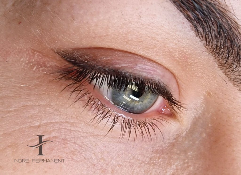 Sugijęs vokų šešėliavimas prieš atliekant korekciją