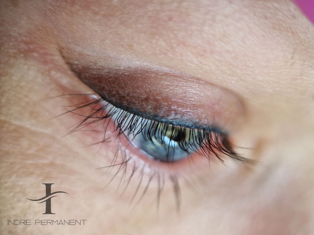 Sugijęs vokų šešėliavimas prieš atliekant korekciją